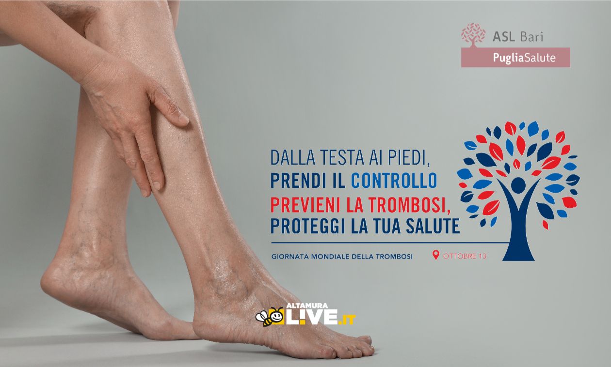 Centro Trombosi del Perinei di Altamura: prevenzione e consulenze gratuite il 13 ottobre - Altamura