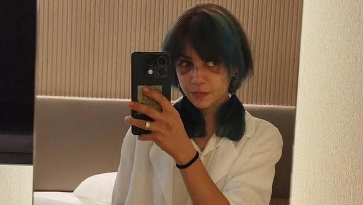 Immagine del post 23488 - Bari Giuditta D’Elia: “Di nuovo accerchiata al parco Rossani, mi hanno detto che pestaggio lo meritavo” - Bari