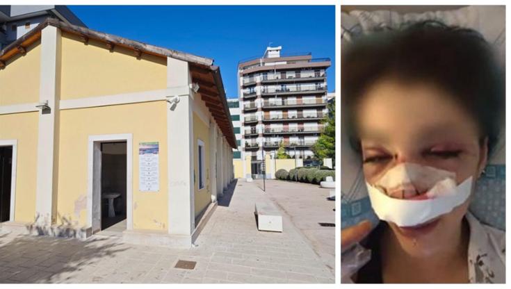 Aggressione Giuditta D’Elia nel parco Rossani: arrestata l’addetta ai bagni. Altre 4 donne indagate - Bari