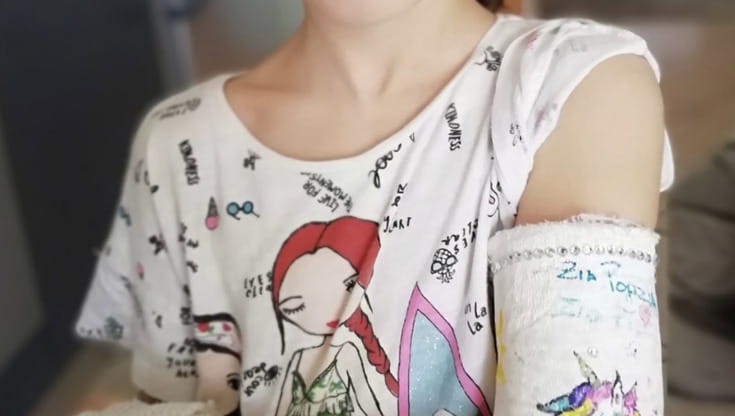 Al Pediatrico di Bari il concorso che premia i bambini con il gesso più creativo - Bari