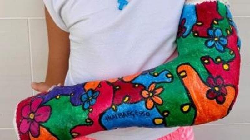 Piccoli capolavori sul gesso, il Pediatrico di Bari premia la fantasia dei piccoli pazienti - Bari