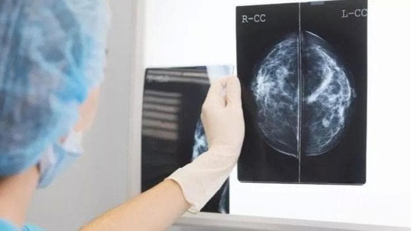 Diagnosi precoce del cancro grazie all’Ai: UniBa nel progetto europeo: “Avrà un impatto concreto” - Bari