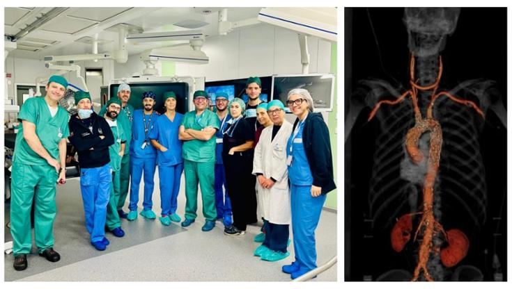 Al Policlinico intervento all’aorta con tecnica mini invasiva: “Paziente di 80 anni inoperabile” - Bari
