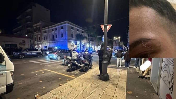 Immagine del post 13663 - Bari Omar picchiato da 20 persone mentre inviava i soldi alla famiglia in Algeria: ''Datemi il telefono'' - Bari