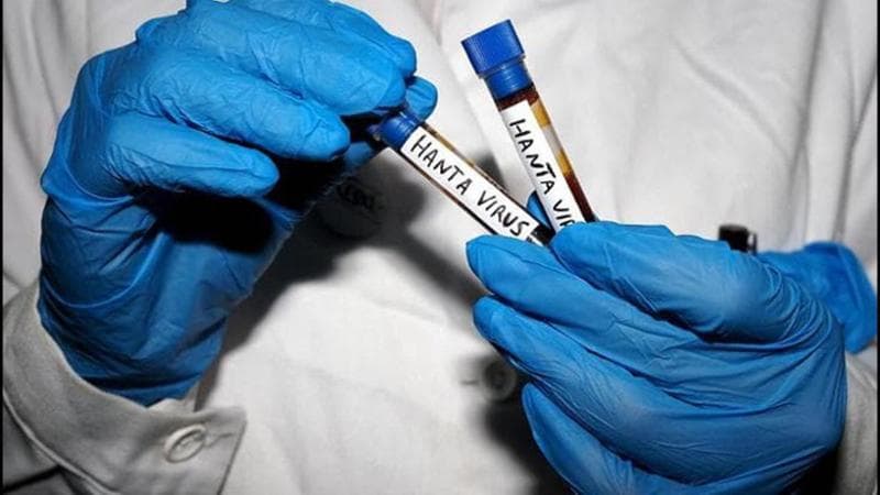 Immagine del post 20428 - Bari Hantavirus, un piano contro i contagi della Regione Puglia: allertati medici, Asl e ospedali - Bari