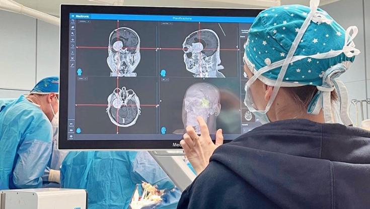 Immagine del post 18292 - Bari Sanità, al Policlinico nel weekend 345 prestazioni. Anticipati interventi cataratta previsti nel ’27 - Bari