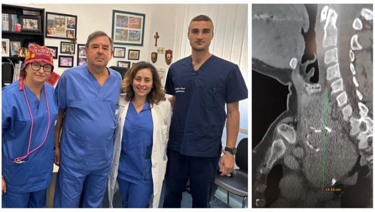 Immagine del post 12693 - Bari Al Policlinico di Bari intervento su donna con raro ingrossamento della tiroide: aveva perso la voce - Bari
