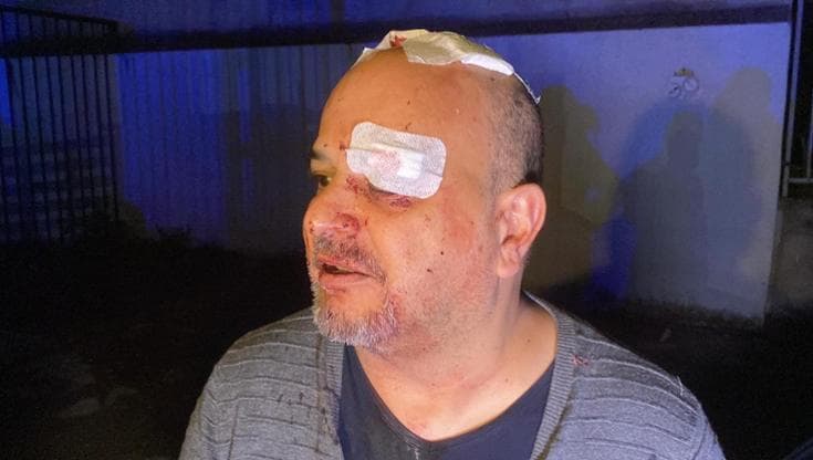 Tentata rapina in azienda a Modugno, ferito alla testa il titolare dopo aver reagito - Bari