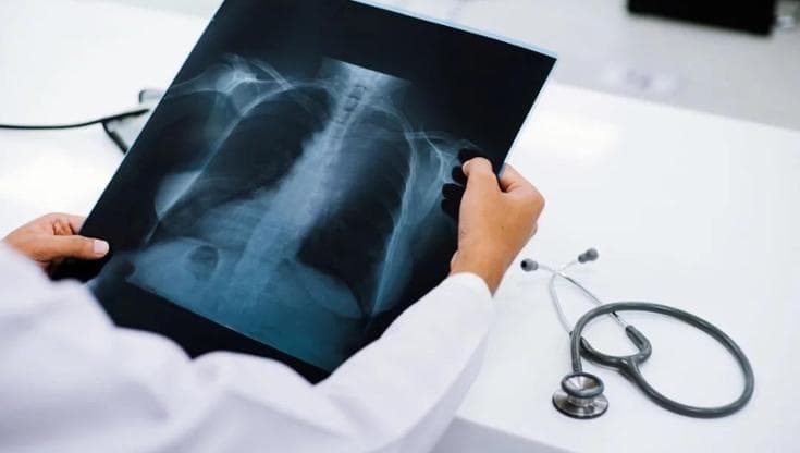 Abusi su una ragazza mentre fa la radiografia, condannato il tecnico. Ma lui continua a lavorare - Bari