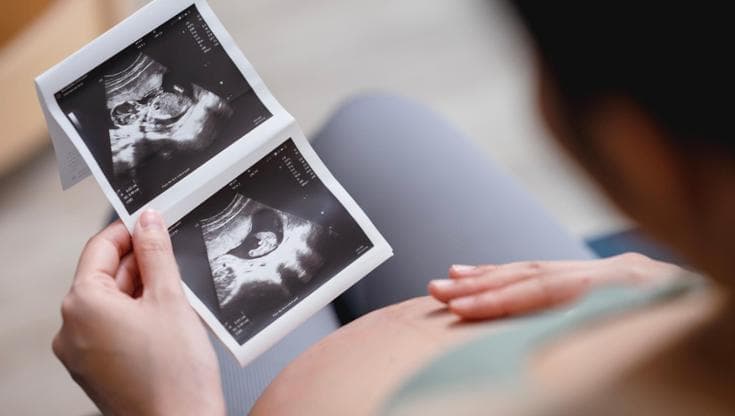 Immagine del post 25176 - Bari “ChatGpt, perché non rimango incinta?”: sei donne su 10 mai informate su fertilità e riproduzione - Bari