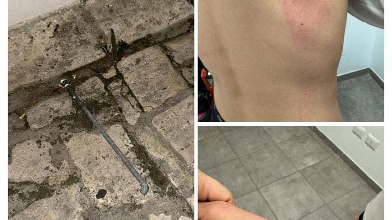 Immagine del post 4494 - Bari Ostuni, difendono un anziano deriso da un gruppo di coetanei: 16enni aggrediti a pugni e sprangate - Bari