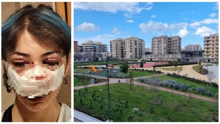 Giuditta d’Elia pestata nel parco, indagati l’addetta ai bagni e il compagno per lesioni e rapina - Bari