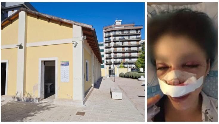 Immagine del post 23356 - Bari “Scusaci Giuditta”, i custodi dei bagni prendono le distanze dalla collega sospesa per il pestaggio - Bari