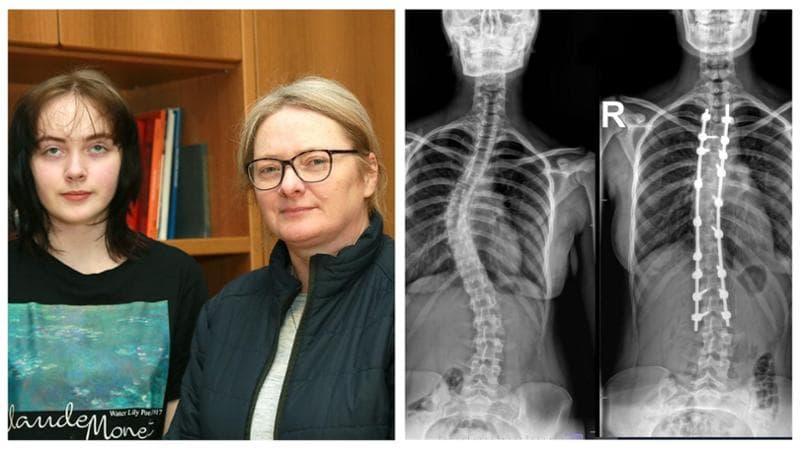 Dall’Irlanda all’ospedale di san Pio per un intervento alla colonna vertebrale: “Guidate dalla fede” - Bari