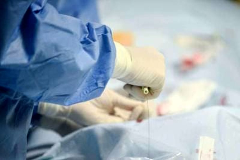 Immagine del post 3970 - Bari Muore 72enne, donazione multiorgano al Miulli: "Gesto di generosità che offre speranza ad altri pazienti" - Bari