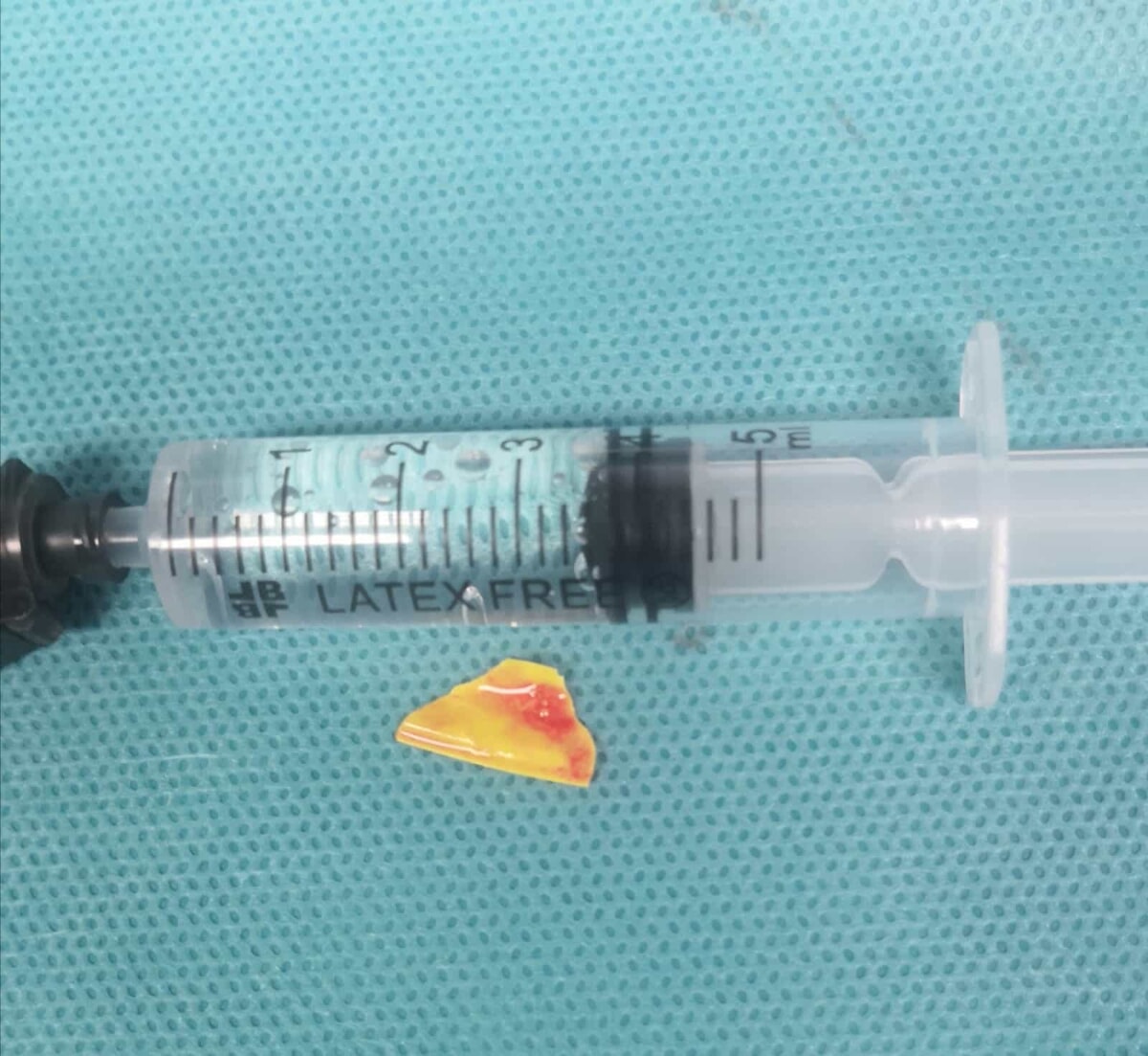 Immagine del post 6342 - Bari Bimba di 14 mesi rischia di soffocare dopo aver ingerito un pezzo di plastica: salvata al Policlinico - Bari