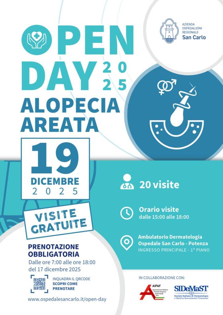 Immagine del post 14959 - Basilicata Alopecia areata, visite gratuite all’ospedale San Carlo di Potenza - Basilicata