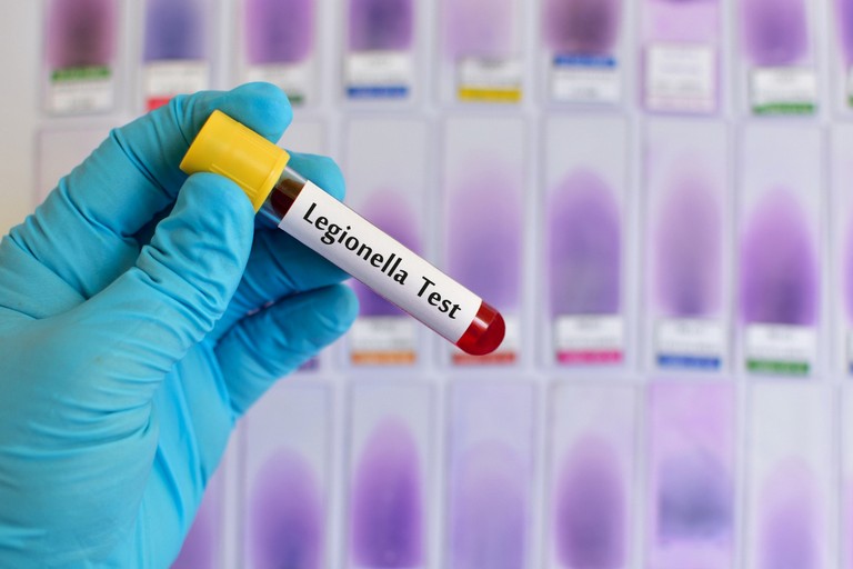 Immagine del post 10834 - Gravina in Puglia Legionella, campagna di prevenzione ASL Bari - Gravina in Puglia