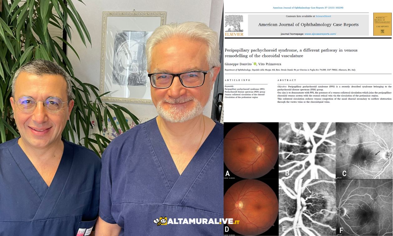 Immagine del post 1041 - Santeramo in Colle Oculistica Perinei, pubblicato studio dei dottori Primavera e Donvito su rivista americana American Journal of Ophthalmology Case Reports - Santeramo in Colle